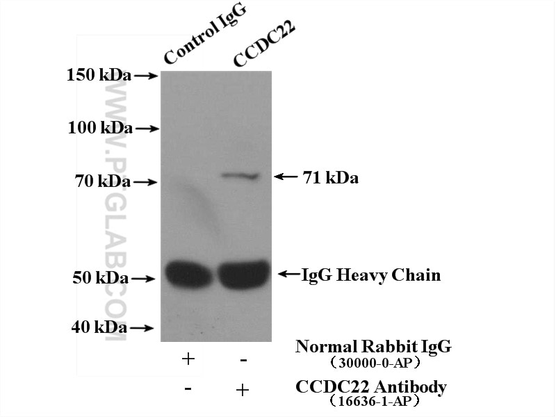 Immunoprecipitation (IP) experiment of mouse lung tissue using CCDC22 Polyclonal antibody (16636-1-AP)