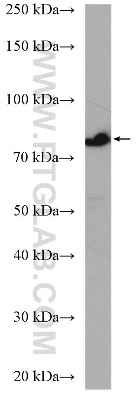 Western Blot (WB) analysis of mouse colon tissue using CCDC22 Polyclonal antibody (16636-1-AP)