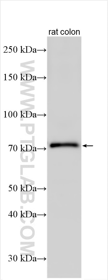 Western Blot (WB) analysis of rat colon tissue using CCDC22 Polyclonal antibody (16636-1-AP)