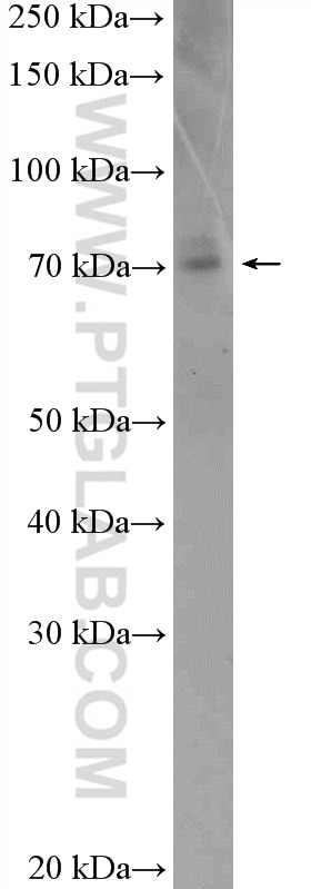 Western Blot (WB) analysis of mouse lung tissue using CCDC22 Polyclonal antibody (16636-1-AP)
