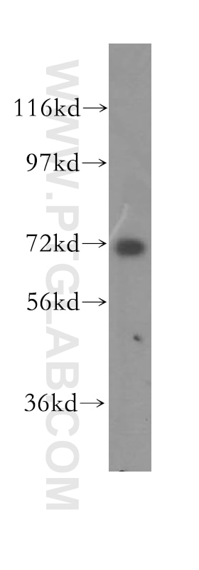 Western Blot (WB) analysis of human brain tissue using CCDC22 Polyclonal antibody (16636-1-AP)