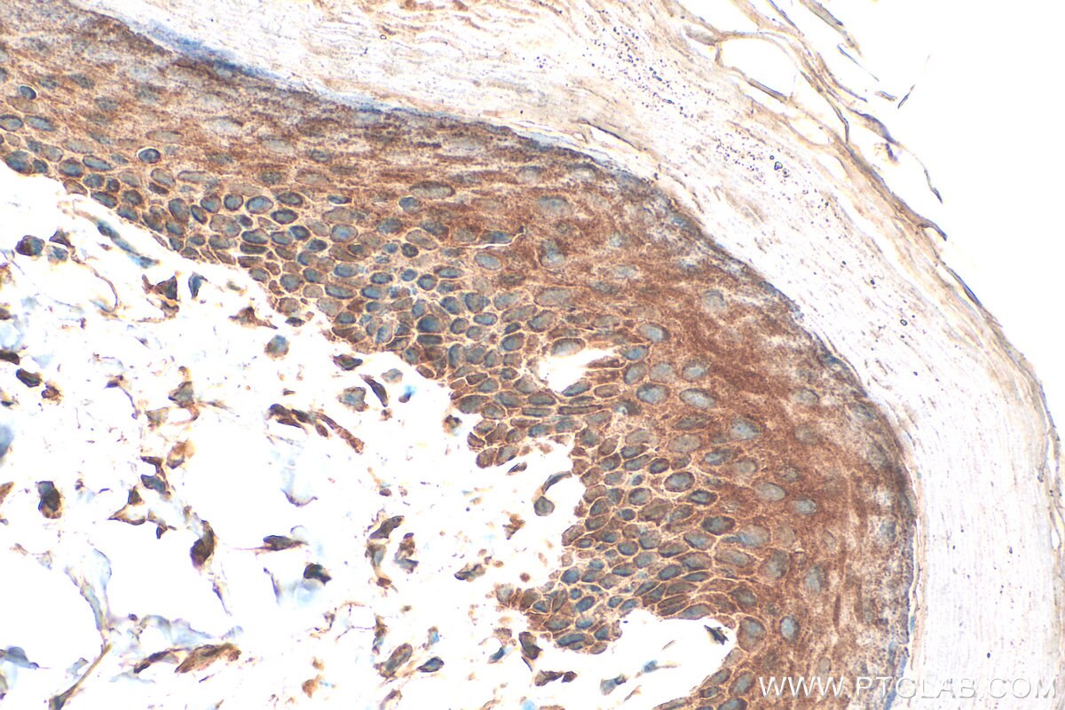 Immunohistochemistry (IHC) staining of mouse skin tissue using CCDC23 Polyclonal antibody (30688-1-AP)