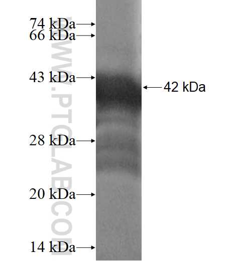 CCDC25 fusion protein Ag15593 SDS-PAGE