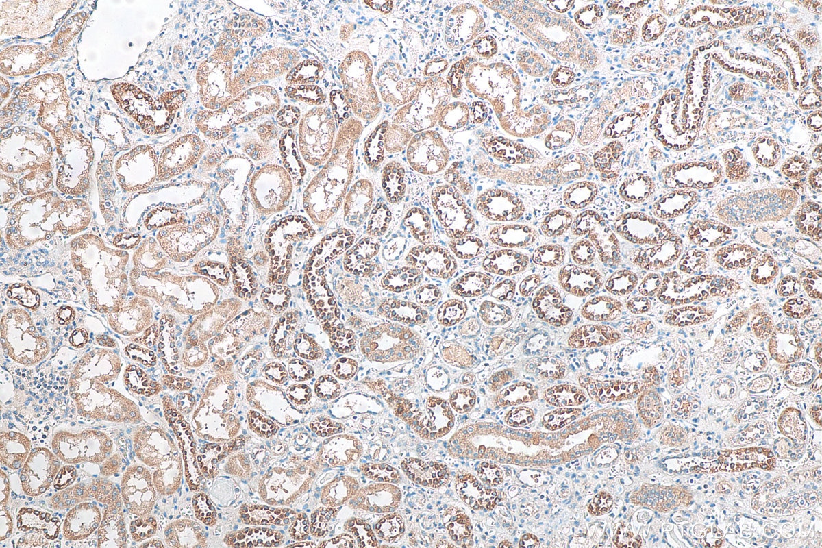 Immunohistochemistry (IHC) staining of human kidney tissue using CCDC27 Polyclonal antibody (23769-1-AP)