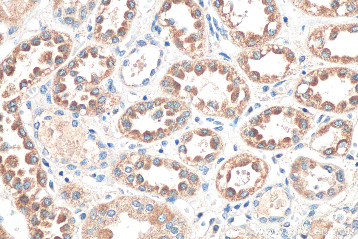 Immunohistochemistry (IHC) staining of human kidney tissue using CCDC27 Polyclonal antibody (23769-1-AP)