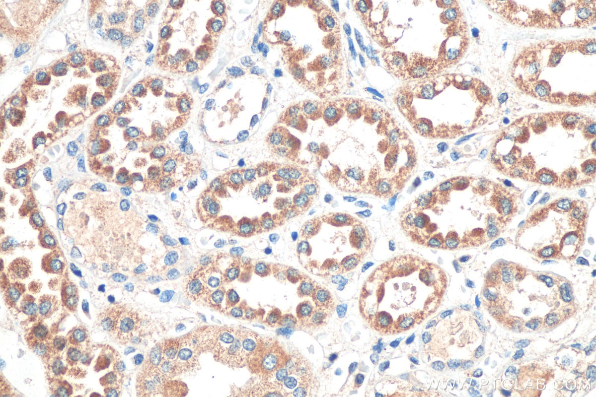 IHC staining of human kidney using 23769-1-AP