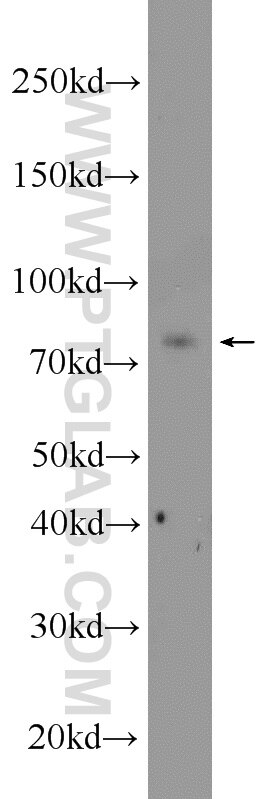 Western Blot (WB) analysis of human testis tissue using CCDC27 Polyclonal antibody (23769-1-AP)