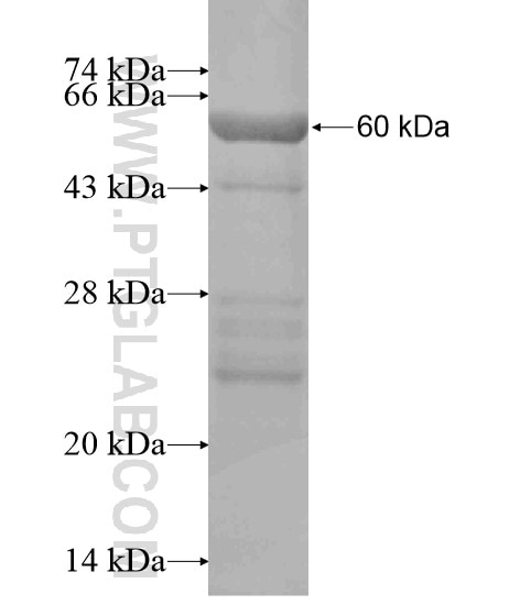 CCDC27 fusion protein Ag20676 SDS-PAGE