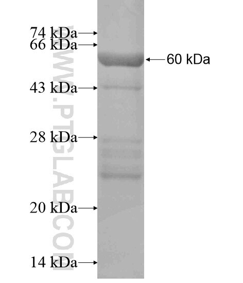 CCDC27 fusion protein Ag20676 SDS-PAGE