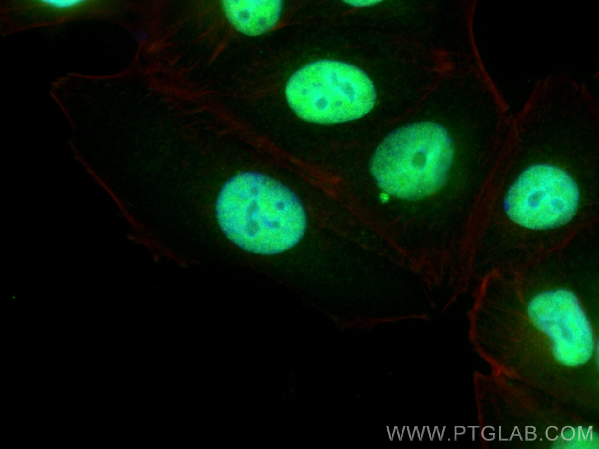 Immunofluorescence (IF) / fluorescent staining of MCF-7 cells using CCDC28A Polyclonal antibody (14807-1-AP)