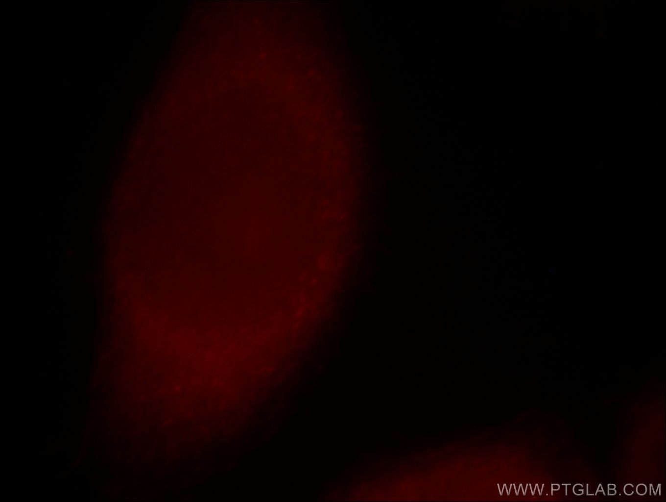 Immunofluorescence (IF) / fluorescent staining of MCF-7 cells using CCDC28A Polyclonal antibody (14807-1-AP)