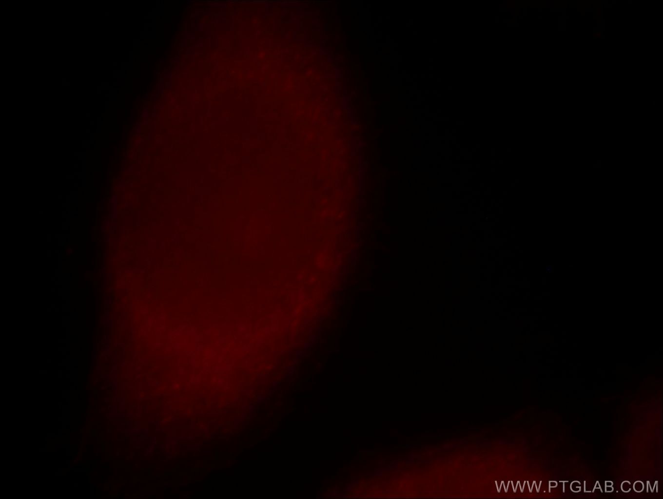 IF Staining of MCF-7 using 14807-1-AP