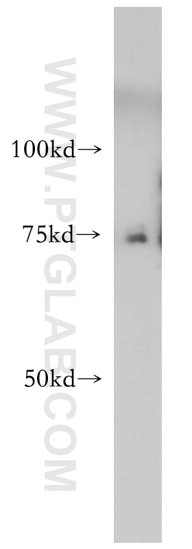 Western Blot (WB) analysis of HeLa cells using CCDC28A Polyclonal antibody (14807-1-AP)