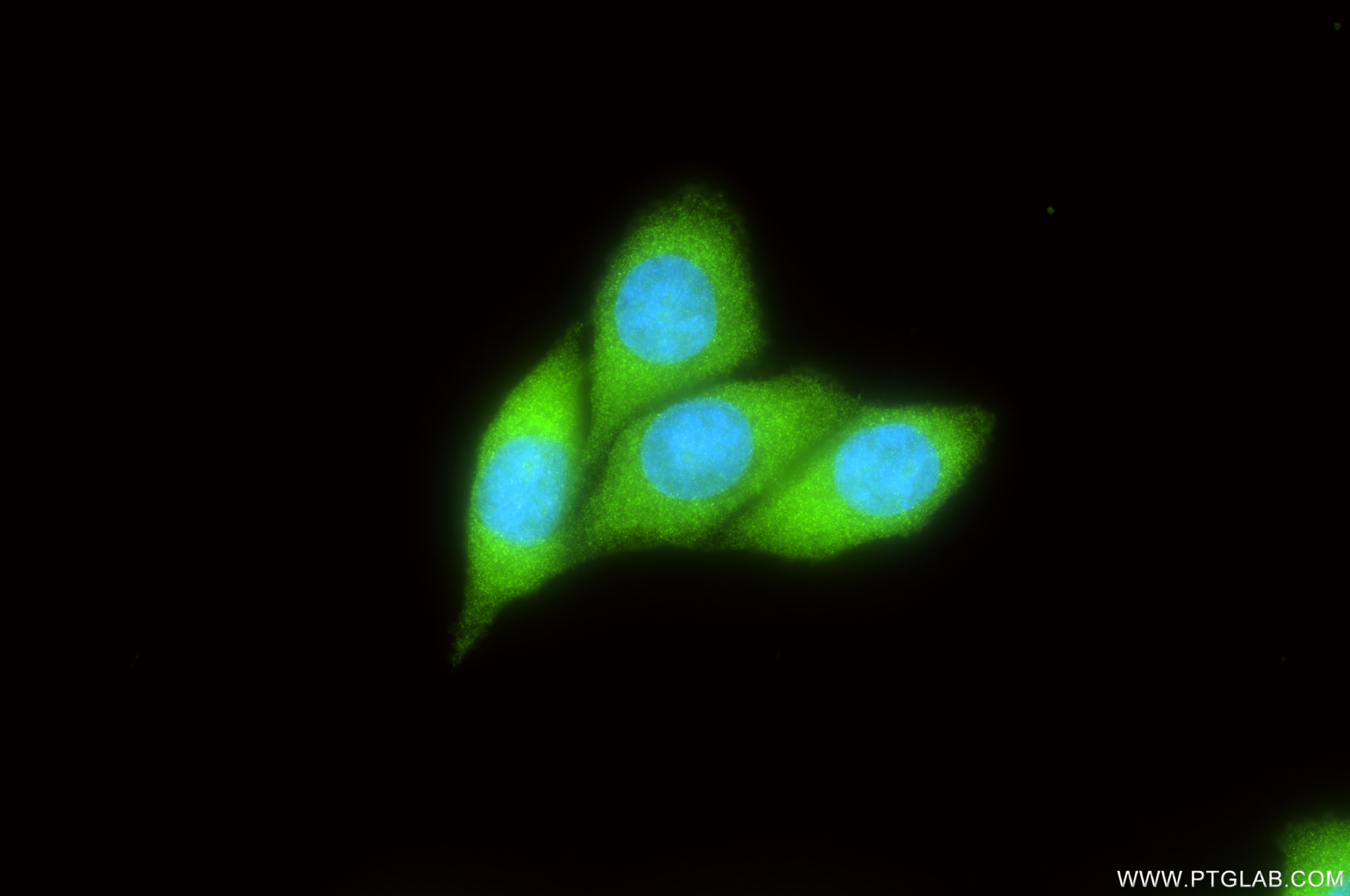 Immunofluorescence (IF) / fluorescent staining of MCF-7 cells using CCDC28A Recombinant monoclonal antibody (86883-1-RR)