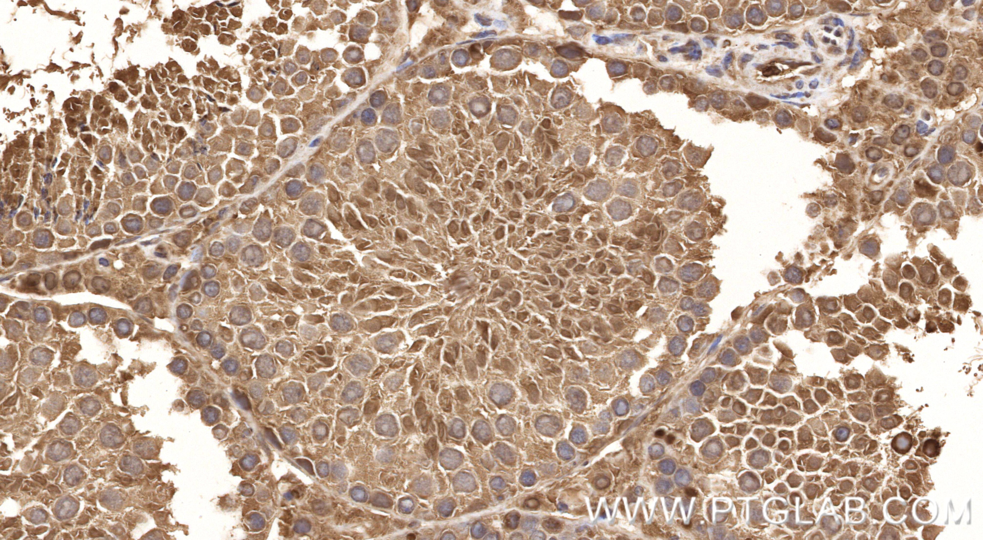 Immunohistochemistry (IHC) staining of mouse testis tissue using CCDC28A Recombinant monoclonal antibody (86883-1-RR)