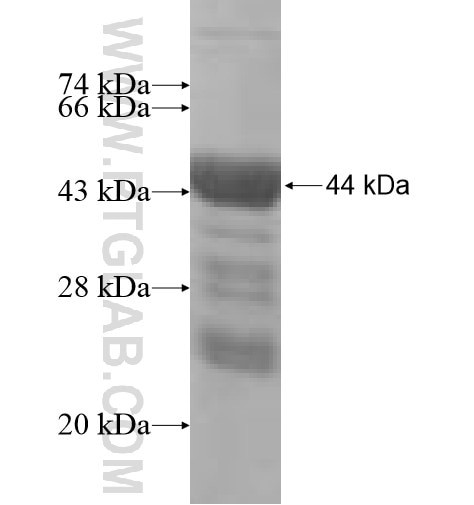 CCDC28A fusion protein Ag6529 SDS-PAGE
