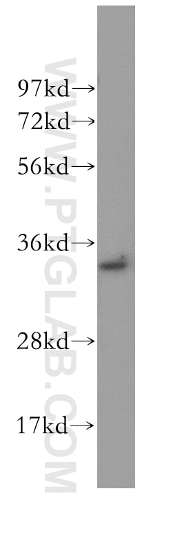 Western Blot (WB) analysis of human brain tissue using CCDC28B Polyclonal antibody (11530-1-AP)