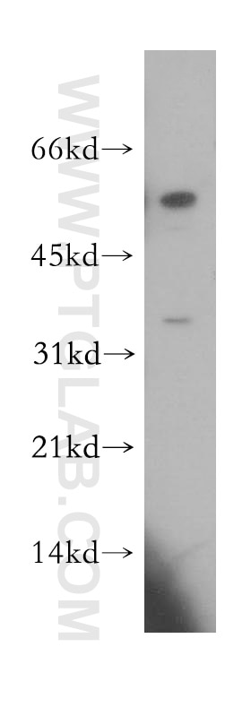Western Blot (WB) analysis of human skeletal muscle tissue using CCDC28B Polyclonal antibody (11530-1-AP)