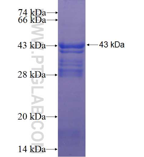 CCDC28B fusion protein Ag2105 SDS-PAGE