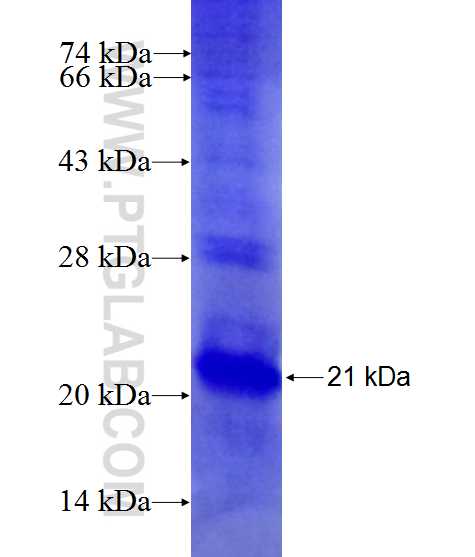 CCDC3 fusion protein Ag27425 SDS-PAGE