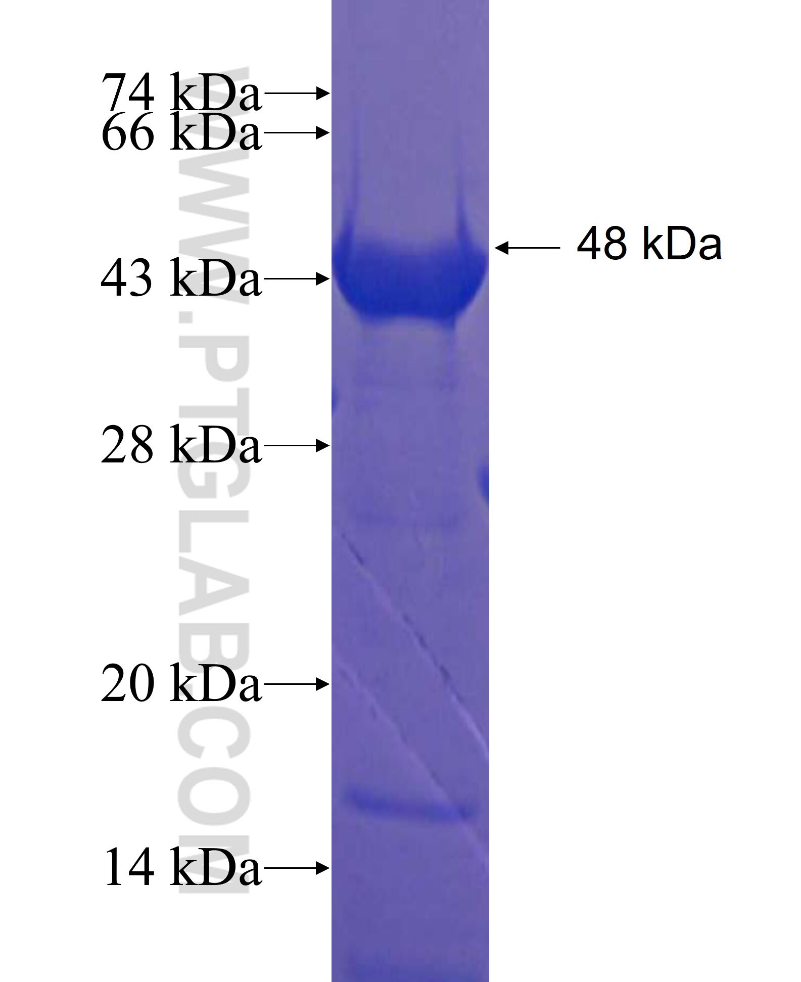 CCDC37 fusion protein Ag22686 SDS-PAGE