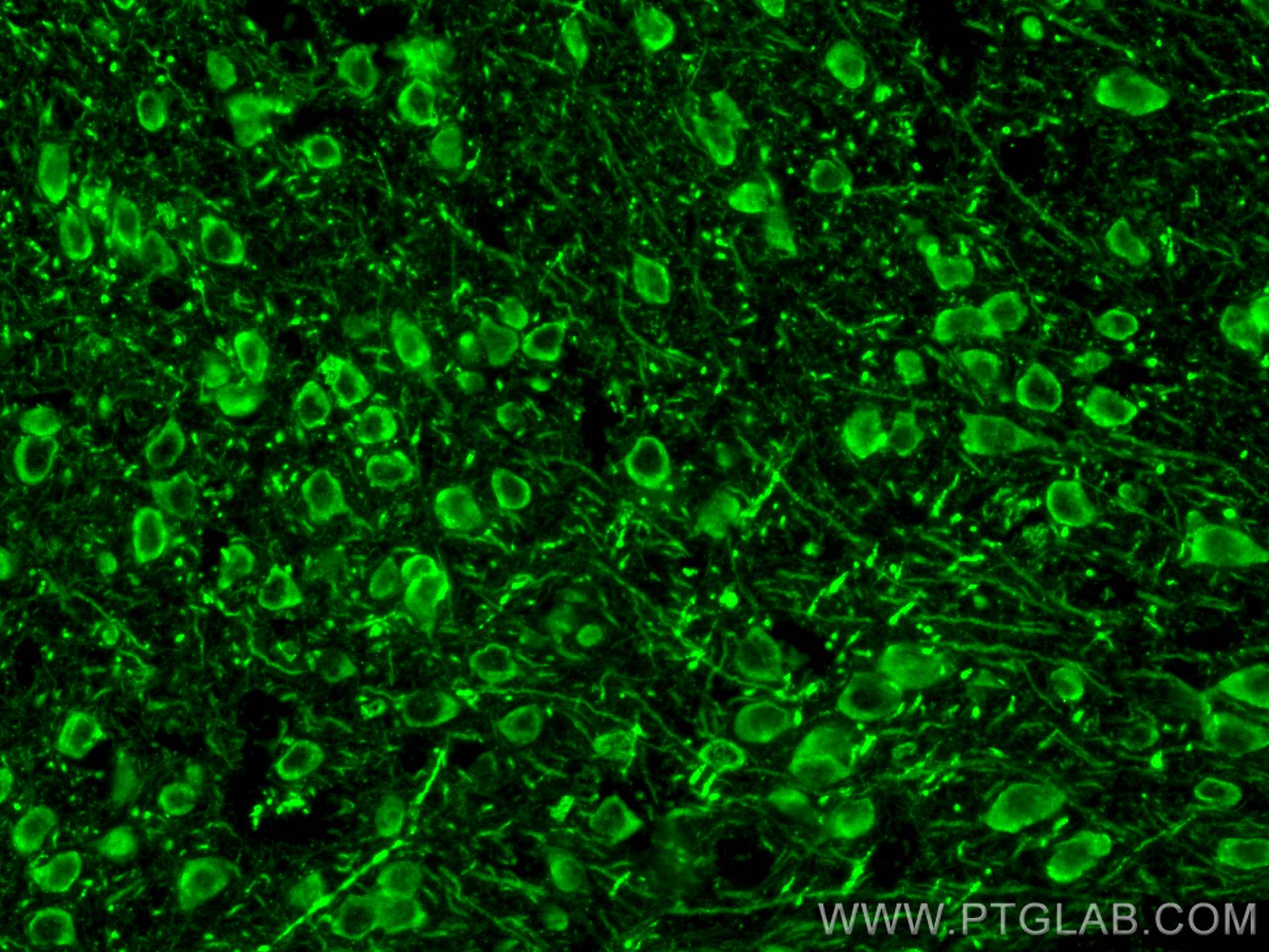 Immunofluorescence (IF) / fluorescent staining of mouse brain tissue using CCDC39 Polyclonal antibody (29817-1-AP)