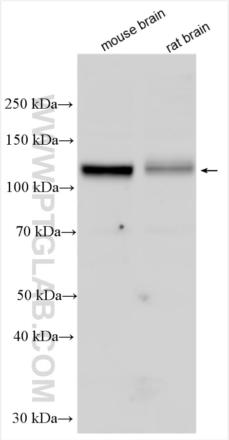 Western Blot (WB) analysis of various lysates using CCDC39 Polyclonal antibody (29817-1-AP)
