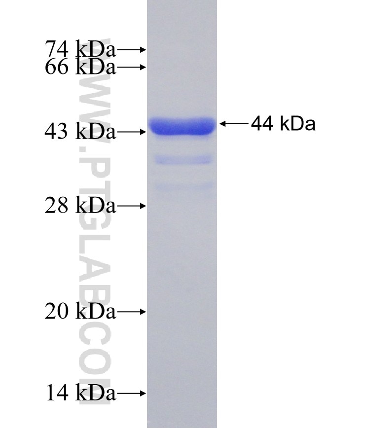 CCDC39 fusion protein Ag31067 SDS-PAGE