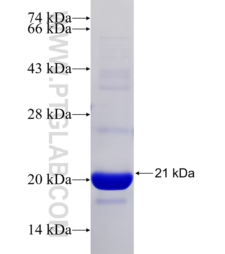 CCDC39 fusion protein Ag31121 SDS-PAGE CCDC39 fusion protein Ag31121 SDS-PAGE