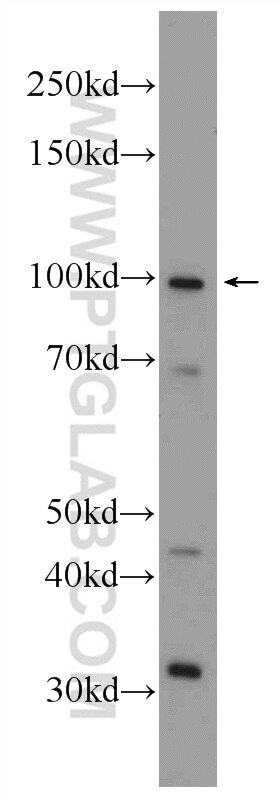 Western Blot (WB) analysis of fetal human brain tissue using CCDC40 Polyclonal antibody (25049-1-AP)