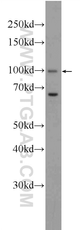 Western Blot (WB) analysis of A549 cells using CCDC40 Polyclonal antibody (25049-1-AP)