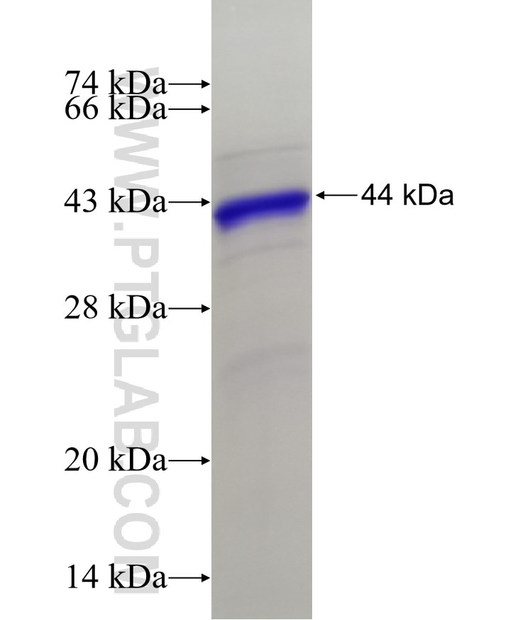 CCDC40 fusion protein Ag20034 SDS-PAGE