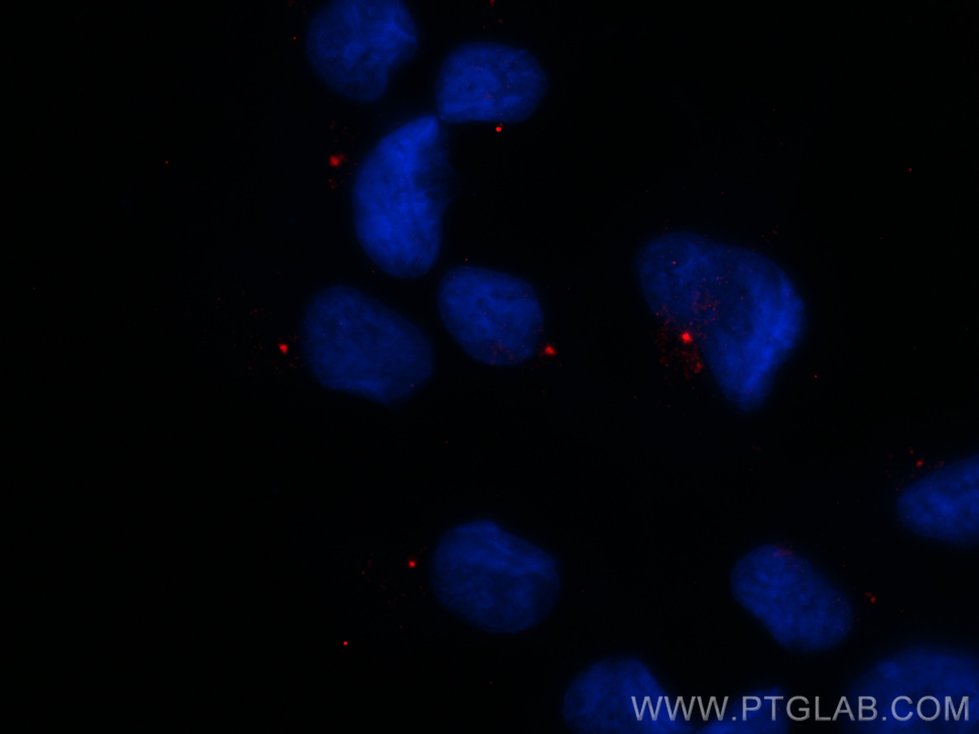 Immunofluorescence (IF) / fluorescent staining of hTERT-RPE1 cells using CEP83 Polyclonal antibody (26013-1-AP)