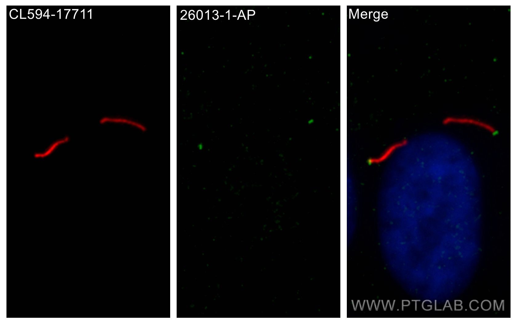 Immunofluorescence (IF) / fluorescent staining of hTERT-RPE1 cells using CEP83 Polyclonal antibody (26013-1-AP)
