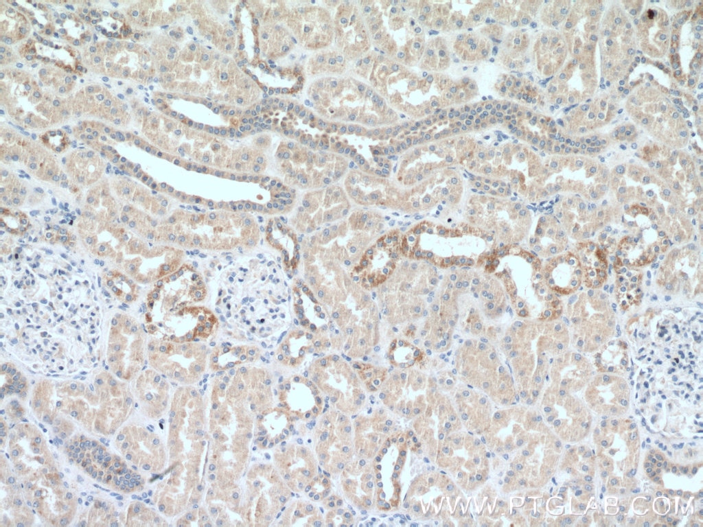 Immunohistochemistry (IHC) staining of human kidney tissue using CEP83 Polyclonal antibody (26013-1-AP)