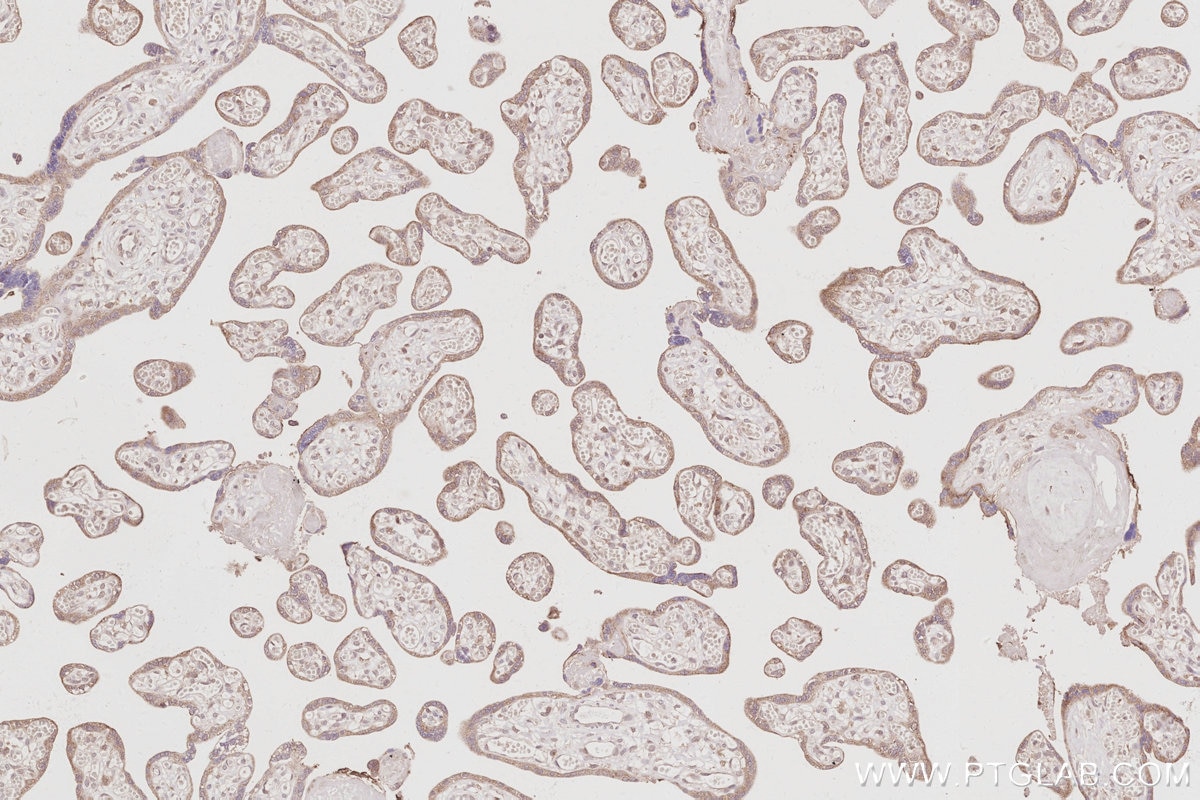 Immunohistochemistry (IHC) staining of human placenta tissue using CEP83 Polyclonal antibody (26013-1-AP)