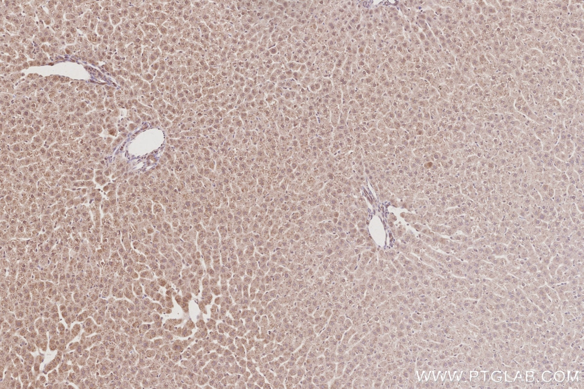 Immunohistochemistry (IHC) staining of rat liver tissue using CEP83 Polyclonal antibody (26013-1-AP)