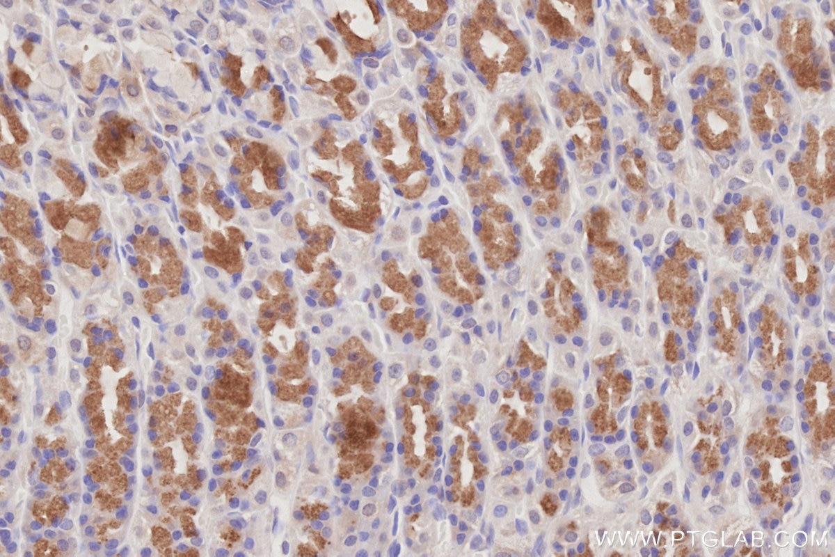 Immunohistochemistry (IHC) staining of rat stomach tissue using CEP83 Polyclonal antibody (26013-1-AP)