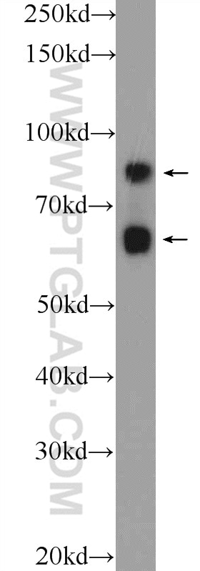 Western Blot (WB) analysis of HEK-293 cells using CEP83 Polyclonal antibody (26013-1-AP)