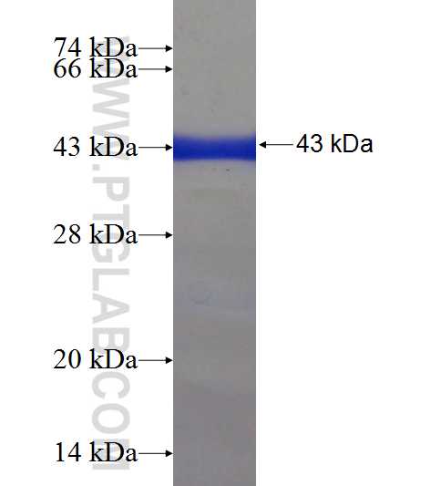 CCDC41 fusion protein Ag22826 SDS-PAGE