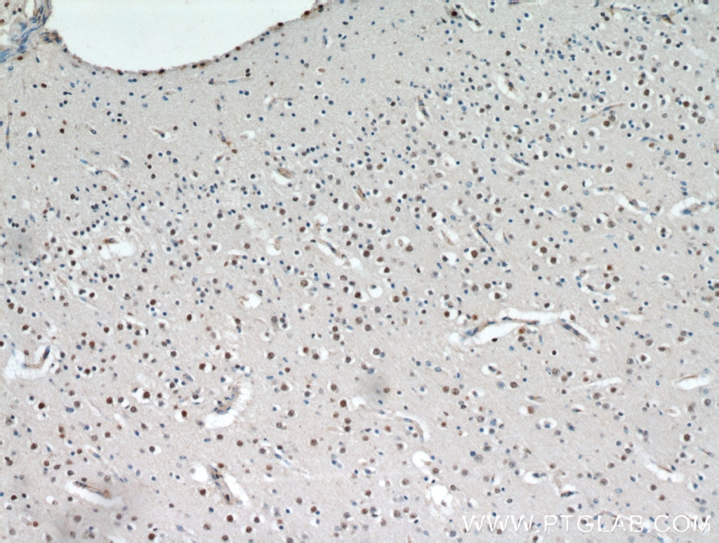Immunohistochemistry (IHC) staining of human brain tissue using CCDC42 Polyclonal antibody (20833-1-AP)