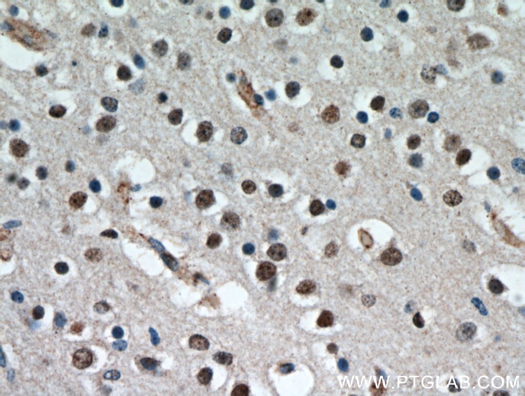 Immunohistochemistry (IHC) staining of human brain tissue using CCDC42 Polyclonal antibody (20833-1-AP)