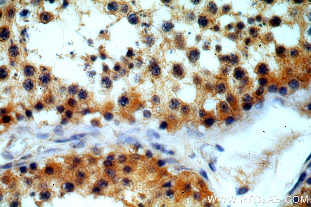 IHC staining of human testis using 20833-1-AP