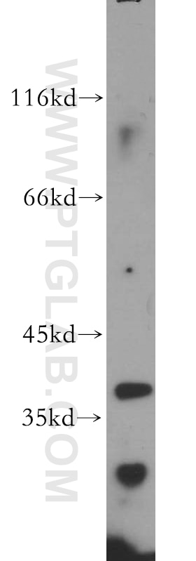 Western Blot (WB) analysis of human testis tissue using CCDC42 Polyclonal antibody (20833-1-AP)