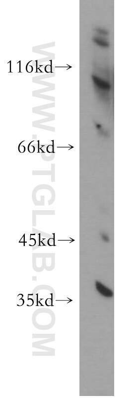 Western Blot (WB) analysis of human brain tissue using CCDC42 Polyclonal antibody (20833-1-AP)