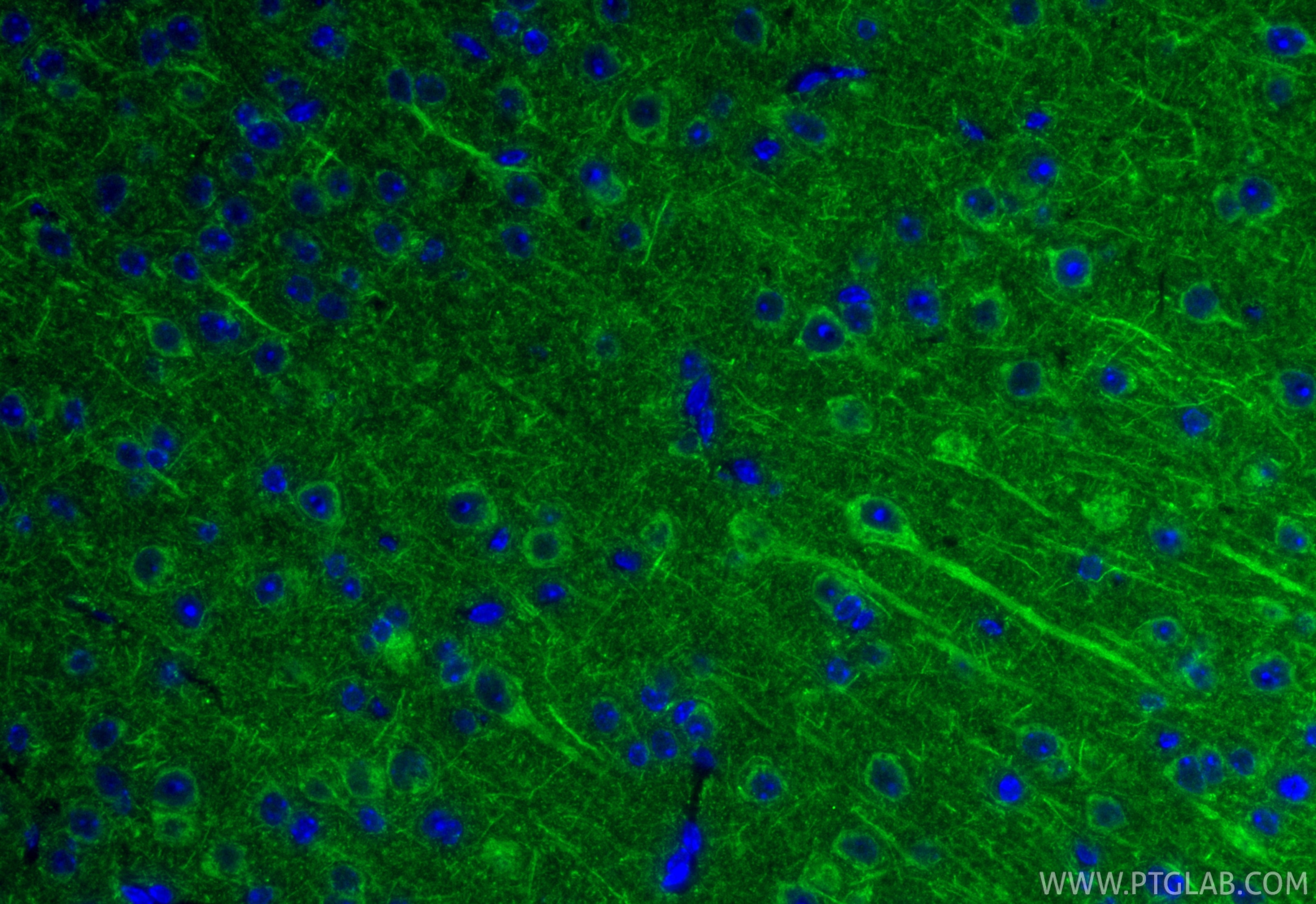 Immunofluorescence (IF) / fluorescent staining of mouse brain tissue using TACO1/CCDC44 Polyclonal antibody (21147-1-AP)