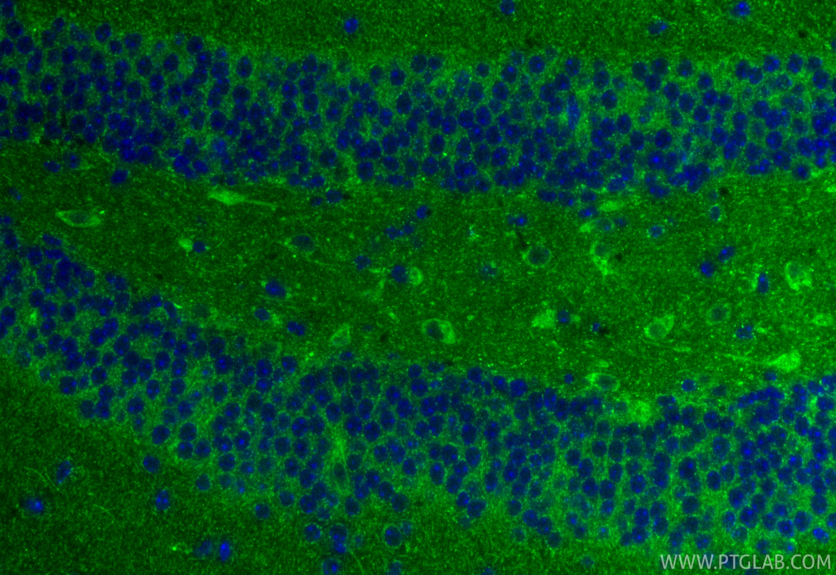 Immunofluorescence (IF) / fluorescent staining of mouse brain tissue using TACO1/CCDC44 Polyclonal antibody (21147-1-AP)
