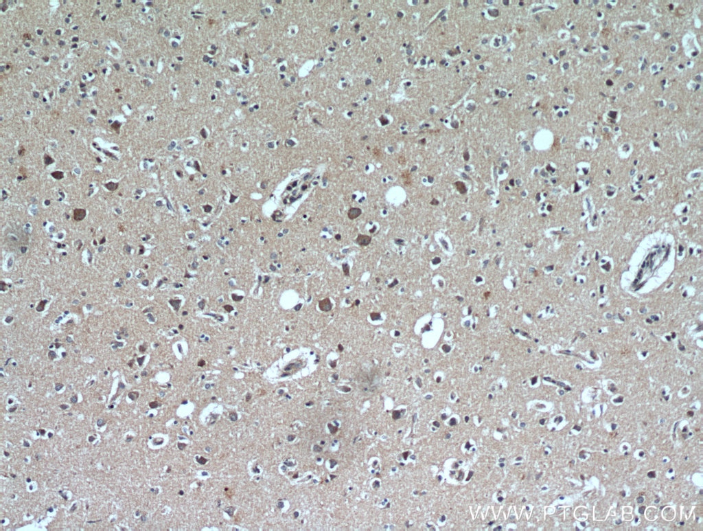 Immunohistochemistry (IHC) staining of human brain tissue using TACO1/CCDC44 Polyclonal antibody (21147-1-AP)