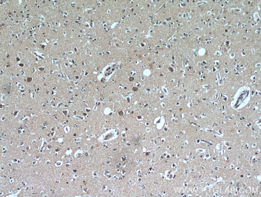 IHC staining of human brain using 21147-1-AP