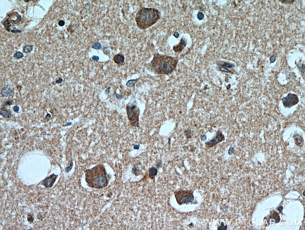 Immunohistochemistry (IHC) staining of human brain tissue using TACO1/CCDC44 Polyclonal antibody (21147-1-AP)